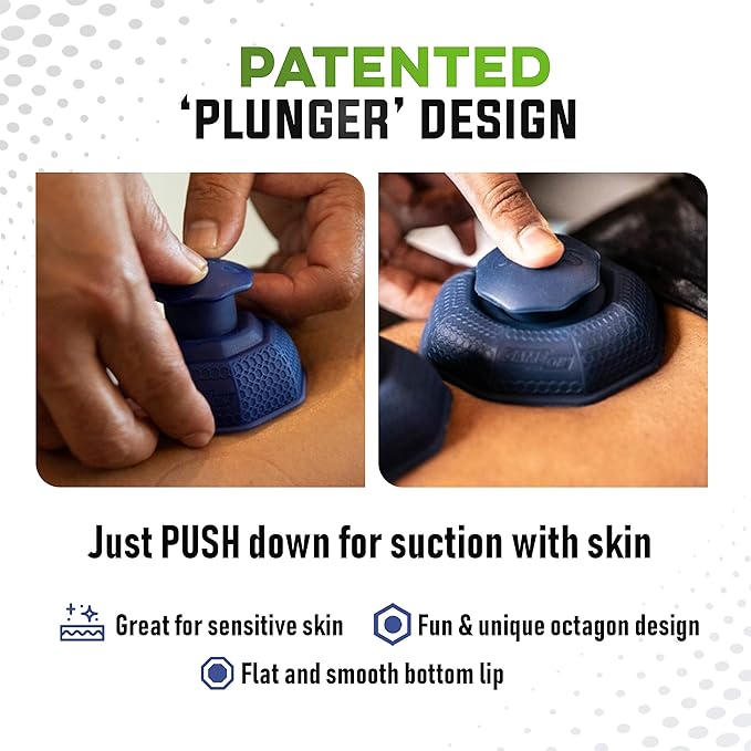 Cupping Therapy Set – Cupping Kit for Massage Therapy – Silicone Cups – Massage Cups – Smart Cupping for Fascia and Myofascial Release (Large, Blue)