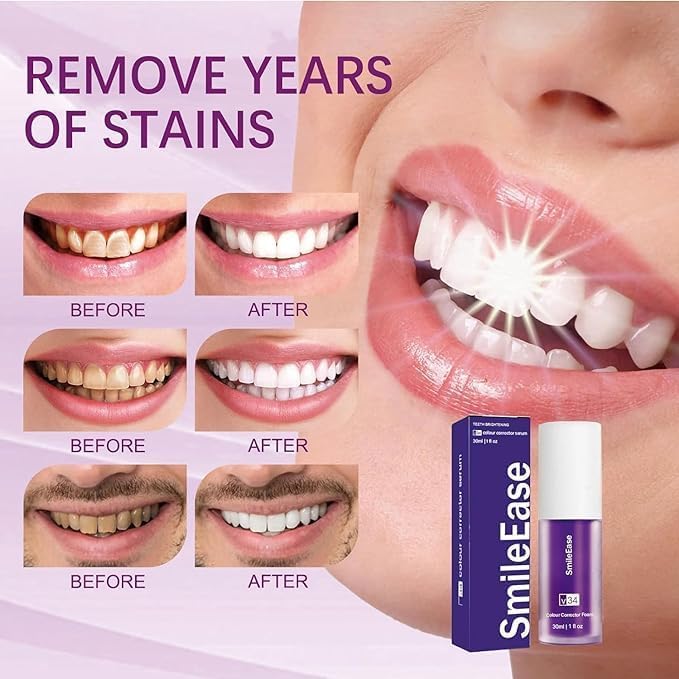 Purple Toothpaste for Teeth Whitening, Purple Whitening Toothpaste for Adults,Tooth Stain Remover Gel - Tooth Whitener Suitable for Smoking, Coffee, and Removing Dental Stone ﻿(2fl oz/60ml)