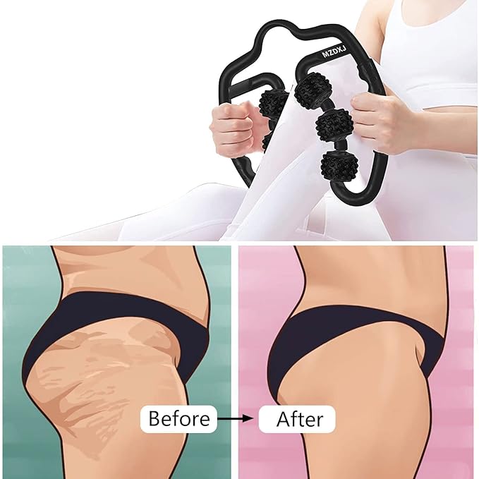 Cellulite Massage Tool Deep Fascia Massager & Dimpled Skin Remover for Legs - Anti-Cellulite Roller Tech with Lymphatic Drainage, Smooth Skin & Pain Relief for Thighs & Buttocks Sculpting