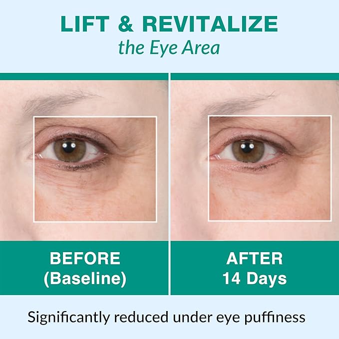 Bliss Face and Body Cupping Therapy Set – Includes Facial Cups for Cupping and Anti-Cellulite Cups - Release Fascia, Lymphatic Drainage, Natural Pain Relief