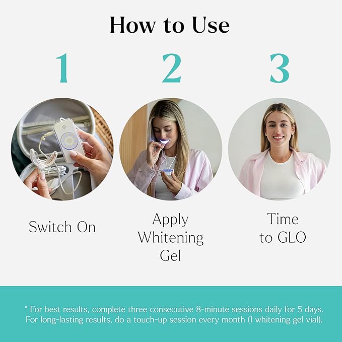 GLO Science So Brilliant Teeth Whitening Kit – Patented Warming Mouthpiece with LED Light Technology, Whitening Gel w/ 6% Hydrogen Peroxide, Lip Balm – Fastest Way to Whiter Teeth, Sensitivity Free