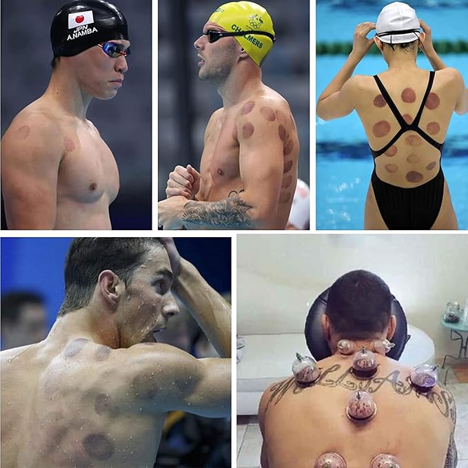 Cupping Kit for Massage Therapy, Silicone Physical Chinese Therapy Cupping Set at Home, Professional Muscle Cupping Tool with Pump & Vacuum Cups for Cellulite Reduction